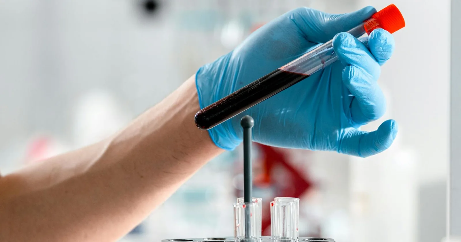 Gloved hand holding a test tube containing a blood sample in a clinical lab, representing the diagnostics behind at-home sensitivity kits.